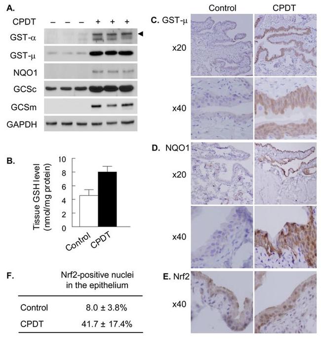 NQO1 Antibody in Immunohistochemistry (IHC)