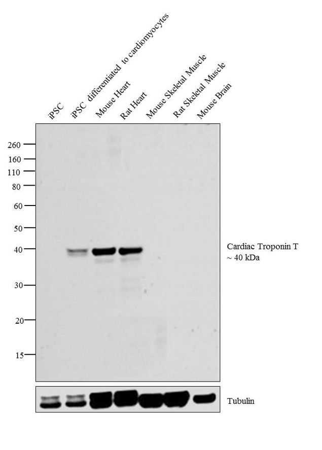 Cardiac Troponin T Antibody