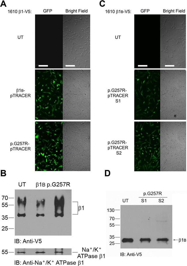 ATP1B1 Antibody in Western Blot (WB)