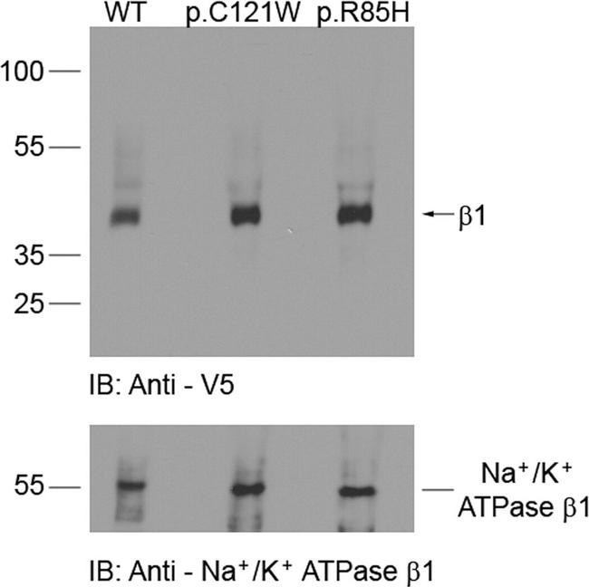 ATP1B1 Antibody in Western Blot (WB)