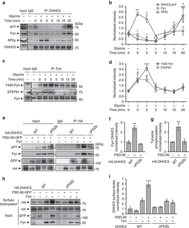 STEP Antibody in Western Blot (WB)