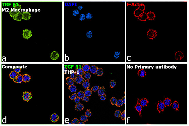 TGF beta-1 Antibody