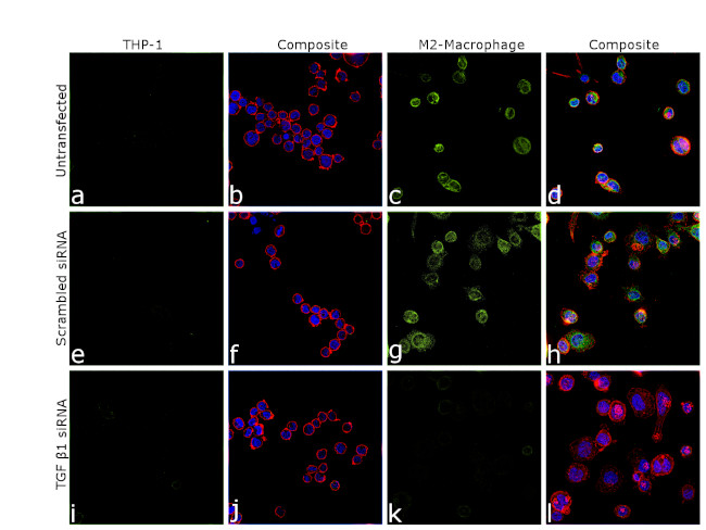 TGF beta-1 Antibody