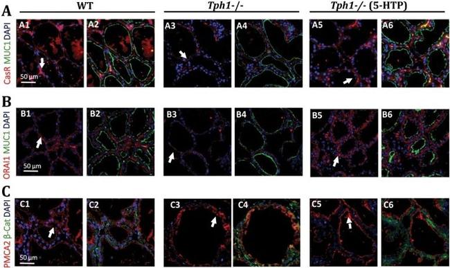 Calcium Sensing Receptor Antibody in Immunohistochemistry (Paraffin) (IHC (P))