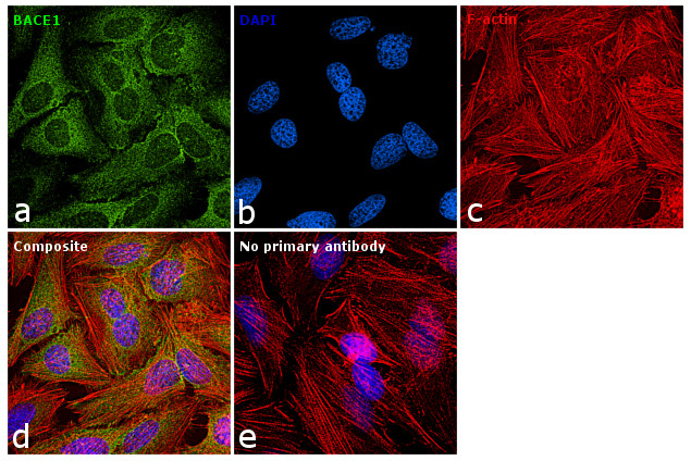 BACE1 Antibody in Immunocytochemistry (ICC/IF)