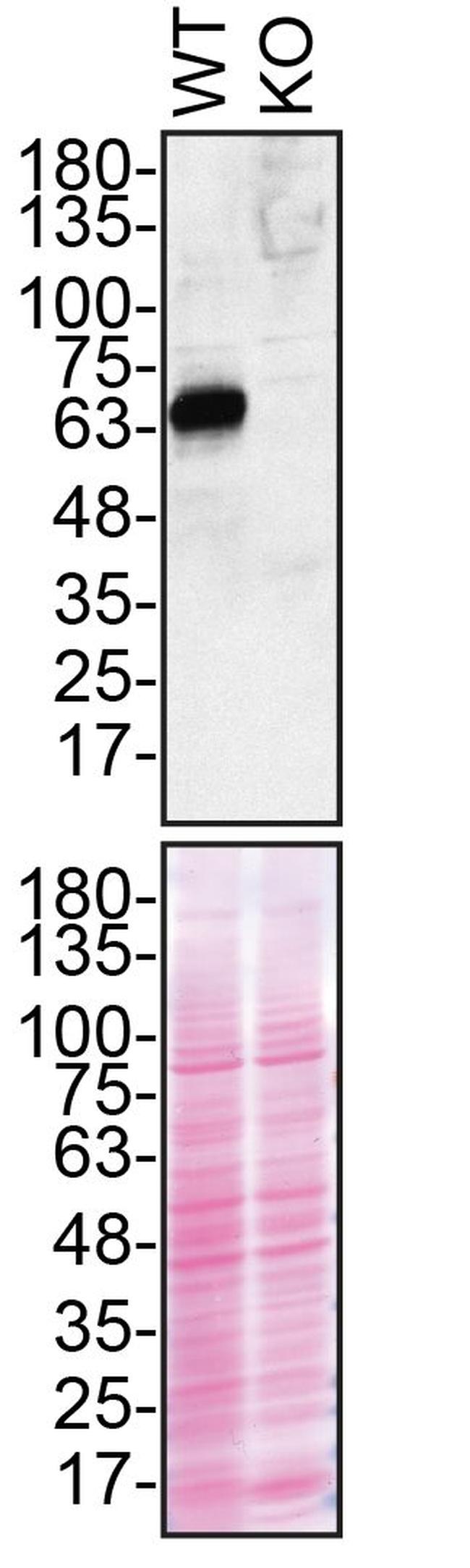 Progranulin Antibody in Western Blot (WB)