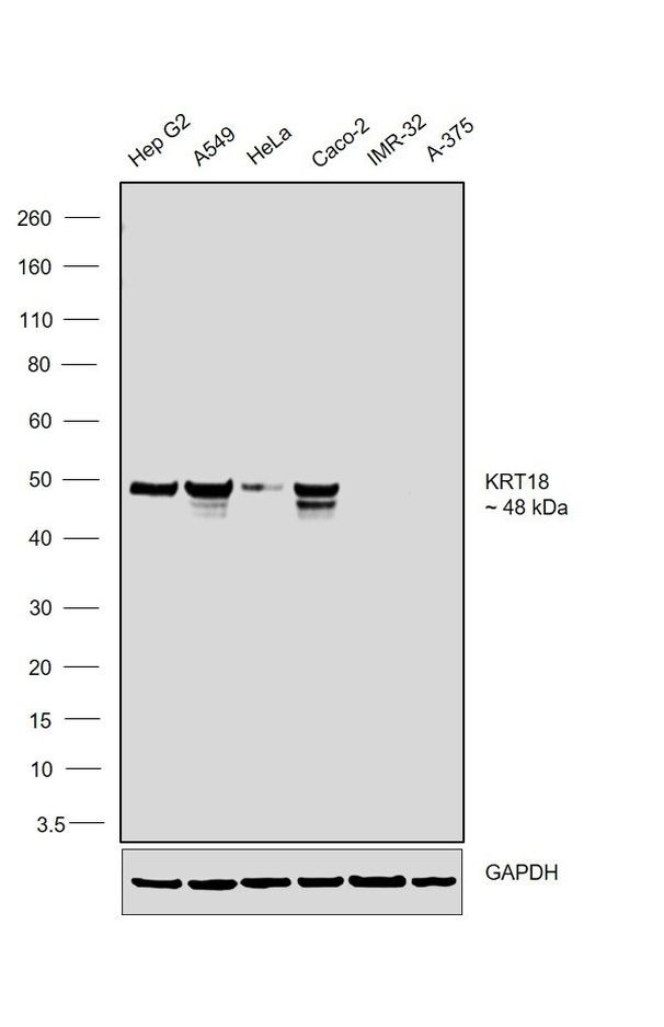 Cytokeratin 18 Antibody