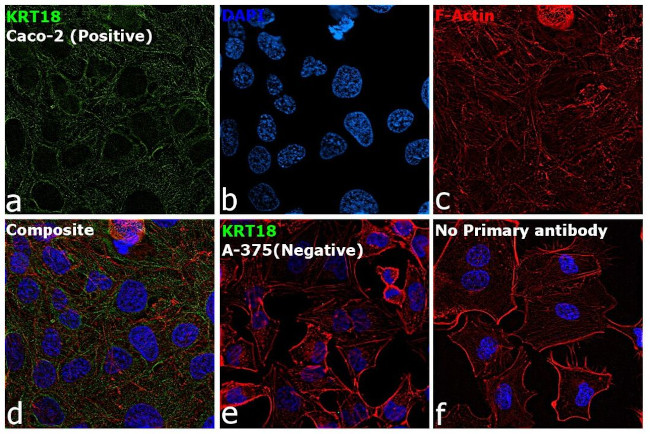 Cytokeratin 18 Antibody in Immunocytochemistry (ICC/IF)