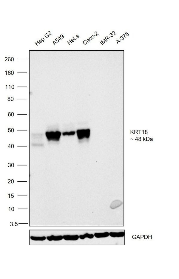 Cytokeratin 18 Antibody