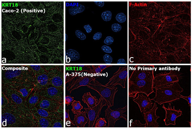 Cytokeratin 18 Antibody in Immunocytochemistry (ICC/IF)