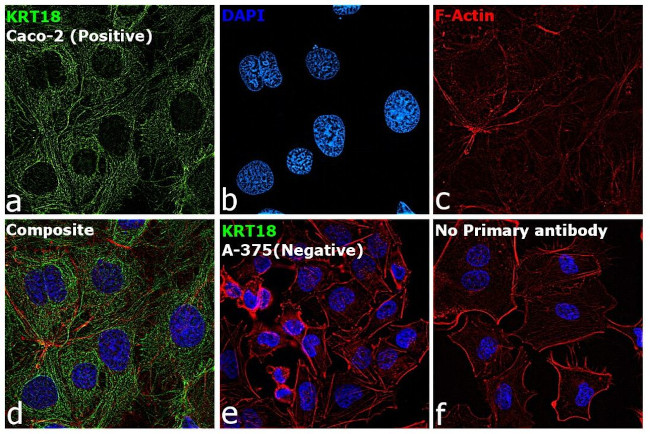 Cytokeratin 18 Antibody in Immunocytochemistry (ICC/IF)