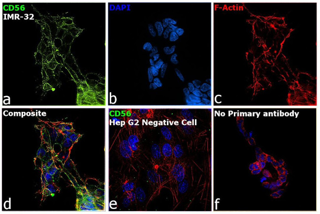 CD56 Antibody