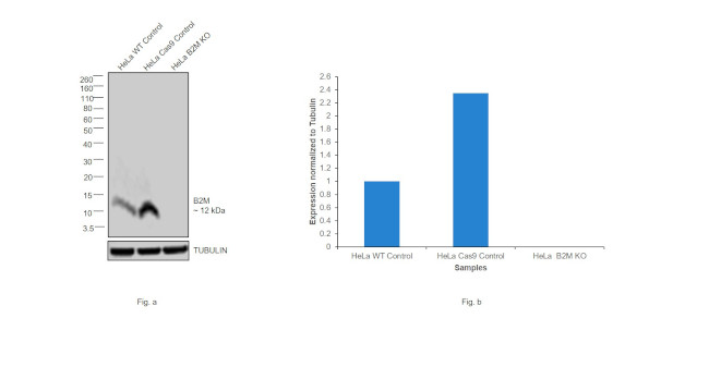 beta-2 Microglobulin Antibody