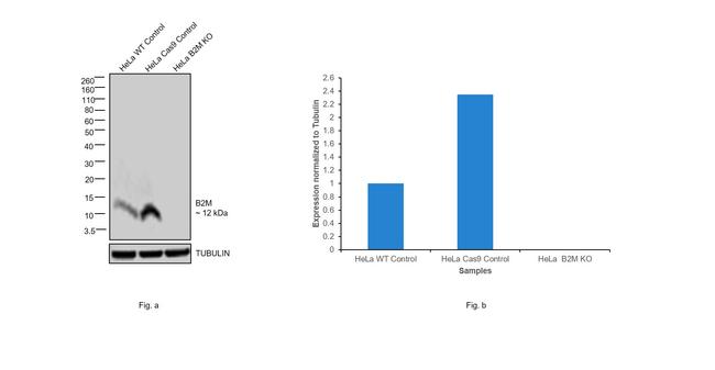 beta-2 Microglobulin Antibody in Western Blot (WB)