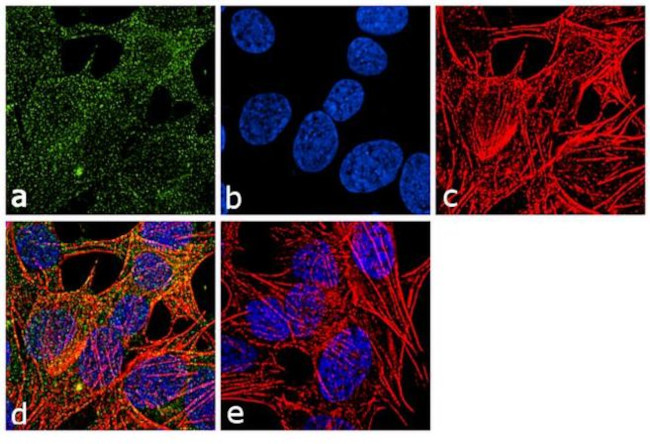 beta Tubulin Antibody in Immunocytochemistry (ICC/IF)