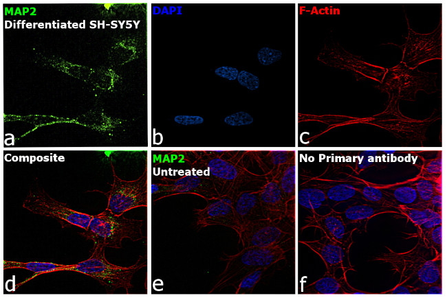 MAP2 Antibody in Immunocytochemistry (ICC/IF)