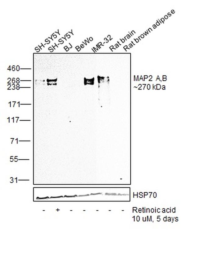 MAP2 Antibody in Western Blot (WB)