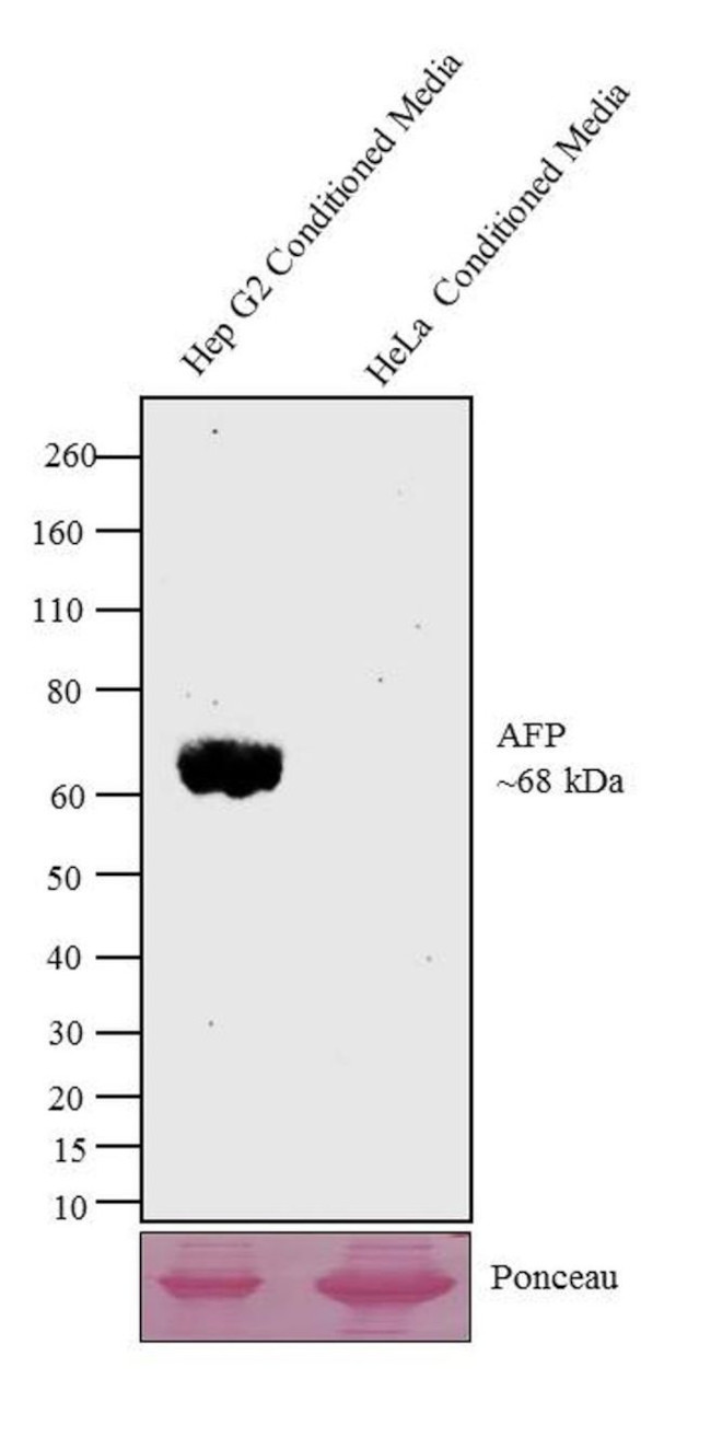 AFP Antibody