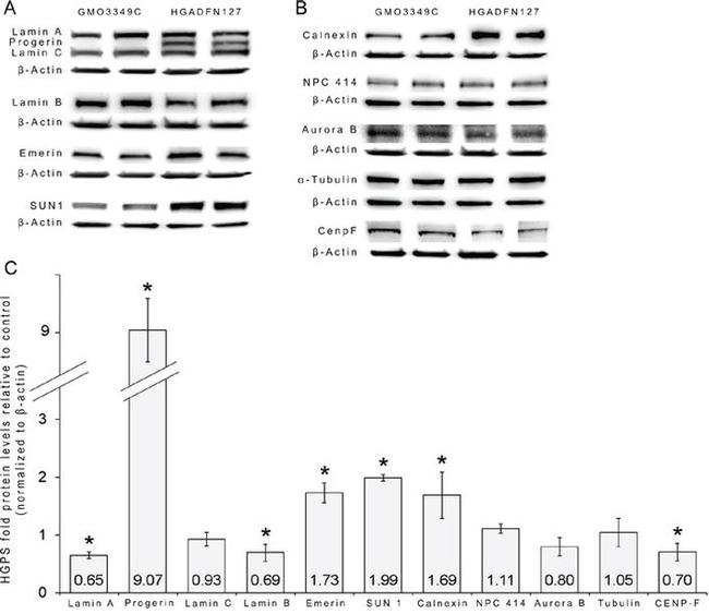 Lamin A/C Antibody in Western Blot (WB)