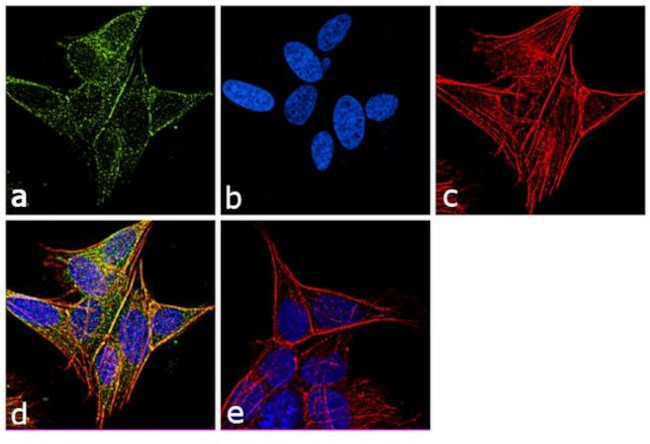 beta-3 Tubulin Antibody in Immunocytochemistry (ICC/IF)