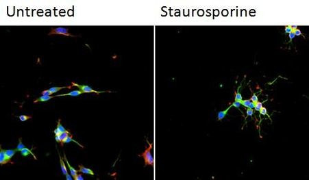 beta-3 Tubulin Antibody in Immunocytochemistry (ICC/IF)