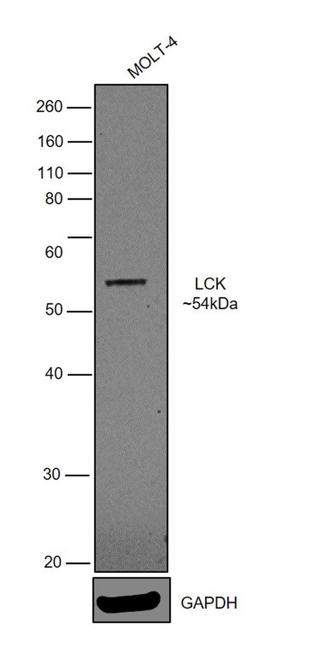 LCK Antibody in Western Blot (WB)