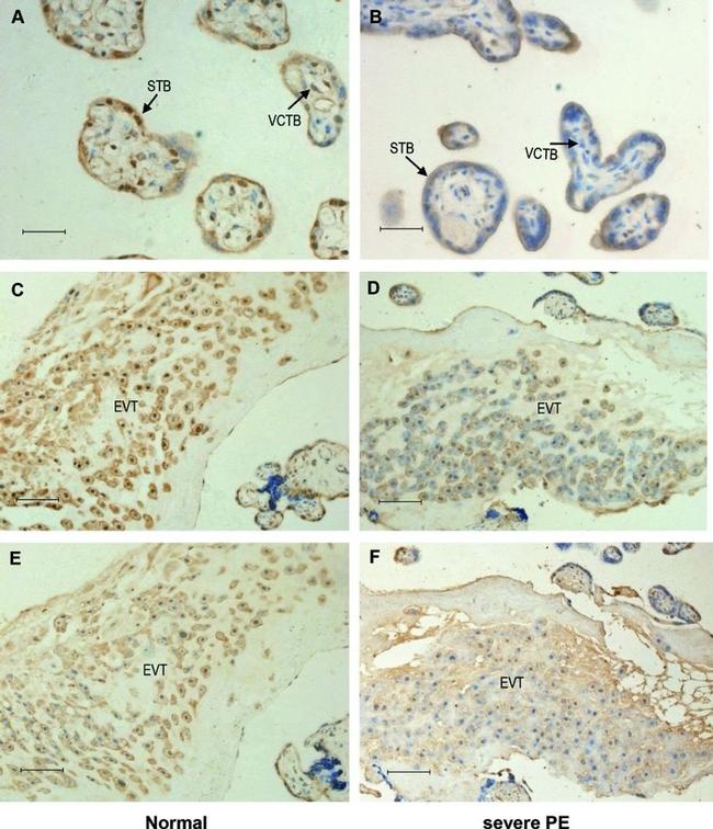 HLA-G Antibody in Immunohistochemistry (IHC)