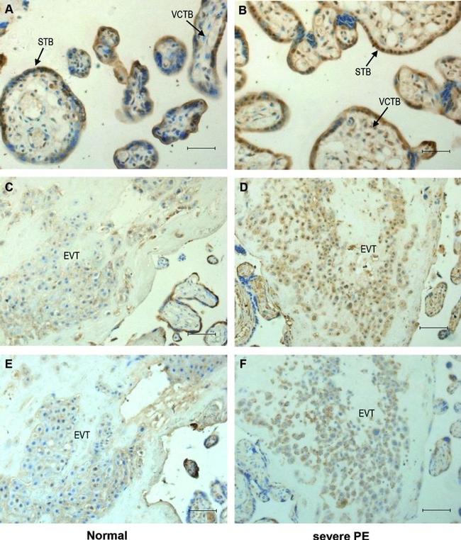 HLA-G Antibody in Immunohistochemistry (IHC)