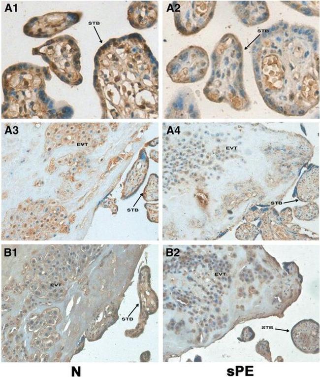 HLA-G Antibody in Immunohistochemistry (IHC)