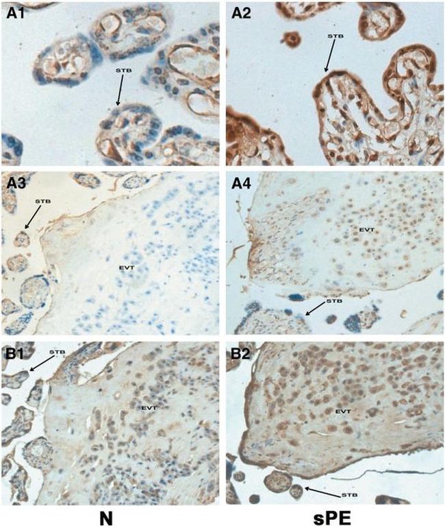 HLA-G Antibody in Immunohistochemistry (IHC)