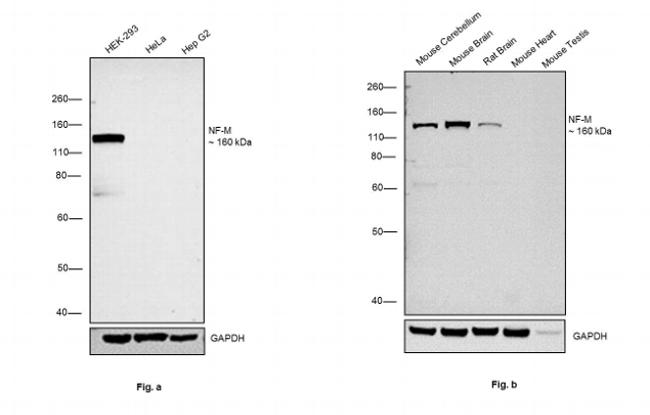 NEFM Antibody in Western Blot (WB)