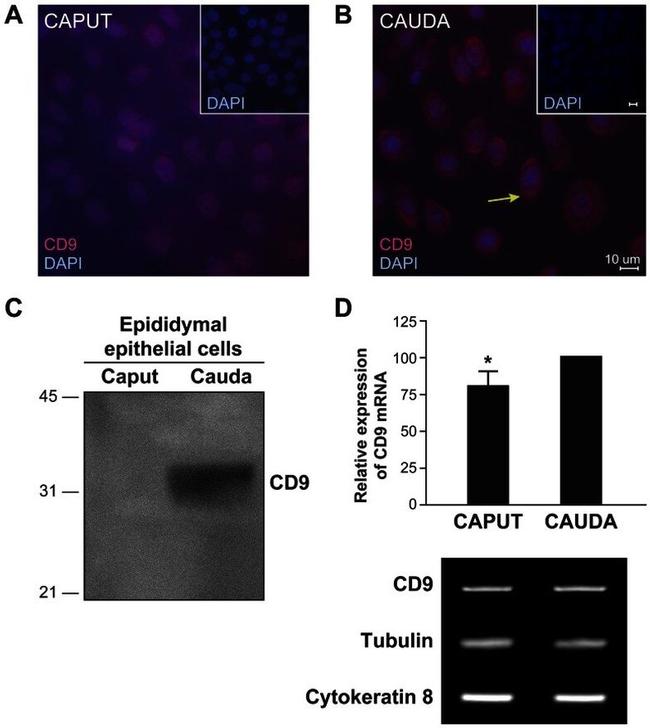 CD9 Antibody in Western Blot, Immunocytochemistry (WB, ICC/IF)