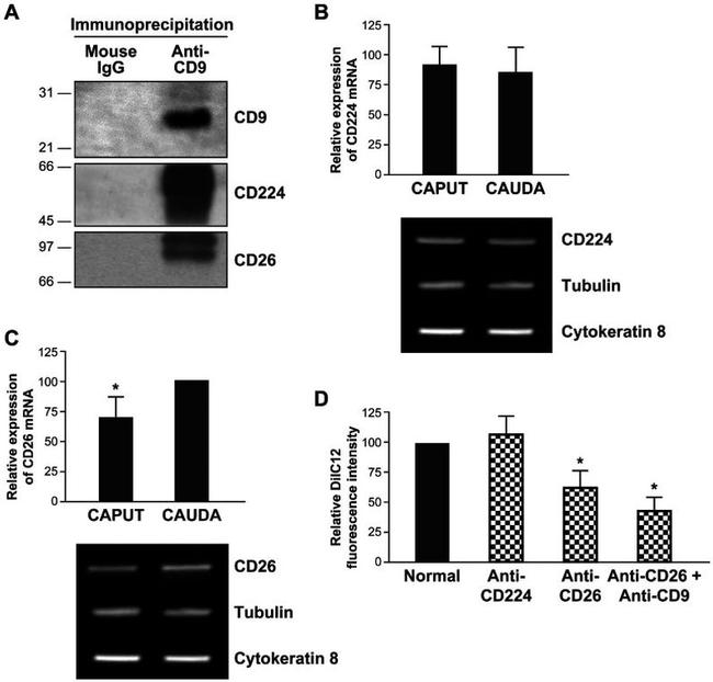 CD9 Antibody in Western Blot, Immunoprecipitation (WB, IP)