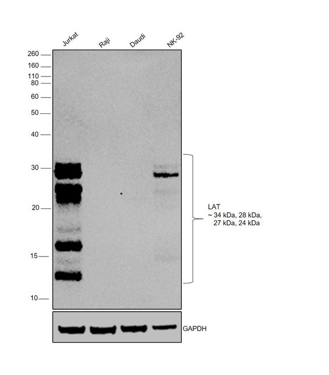 LAT Antibody in Western Blot (WB)