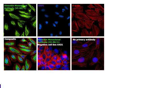 Vimentin Antibody in Immunocytochemistry (ICC/IF)