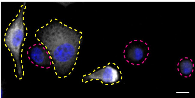 Syk Antibody