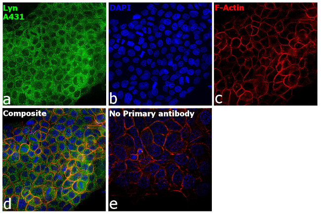 Lyn Antibody in Immunocytochemistry (ICC/IF)