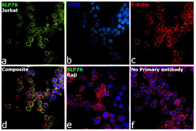 SLP76 Antibody in Immunocytochemistry (ICC/IF)