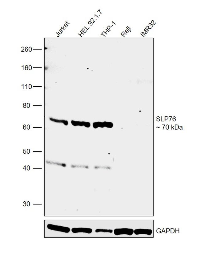 SLP76 Antibody in Western Blot (WB)