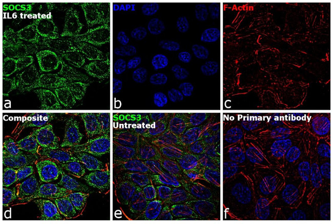 SOCS3 Antibody in Immunocytochemistry (ICC/IF)