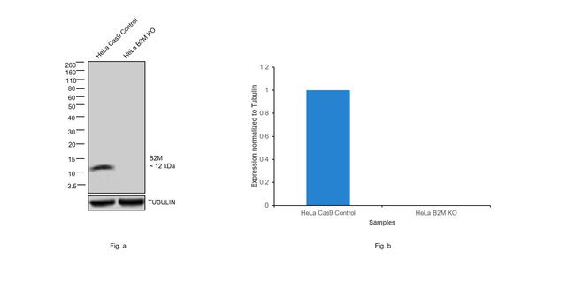 beta-2 Microglobulin Antibody in Western Blot (WB)