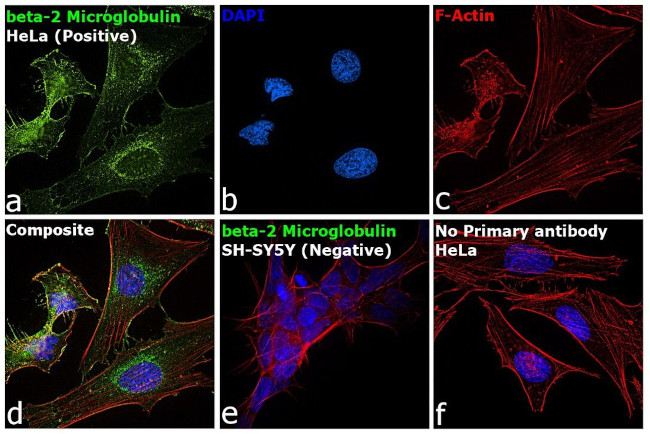 beta-2 Microglobulin Antibody