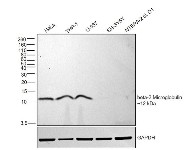 beta-2 Microglobulin Antibody in Western Blot (WB)