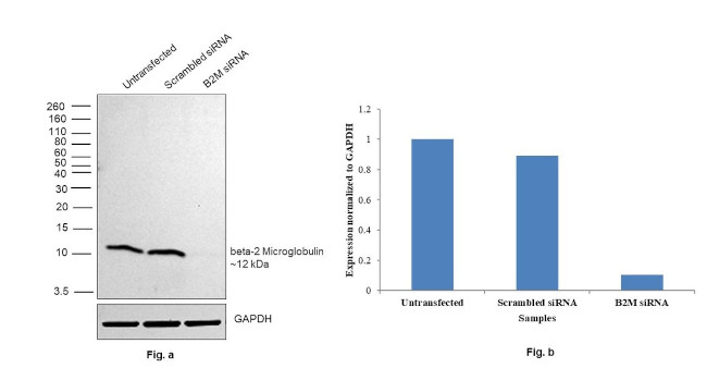 beta-2 Microglobulin Antibody