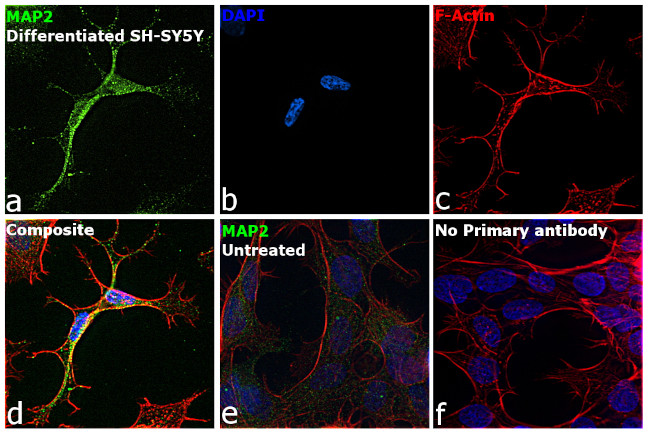 MAP2 Antibody in Immunocytochemistry (ICC/IF)