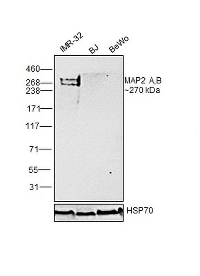 MAP2 Antibody in Western Blot (WB)