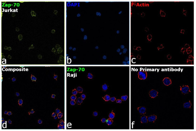 Zap-70 Antibody in Immunocytochemistry (ICC/IF)