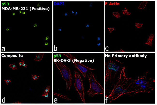 p53 Antibody in Immunocytochemistry (ICC/IF)