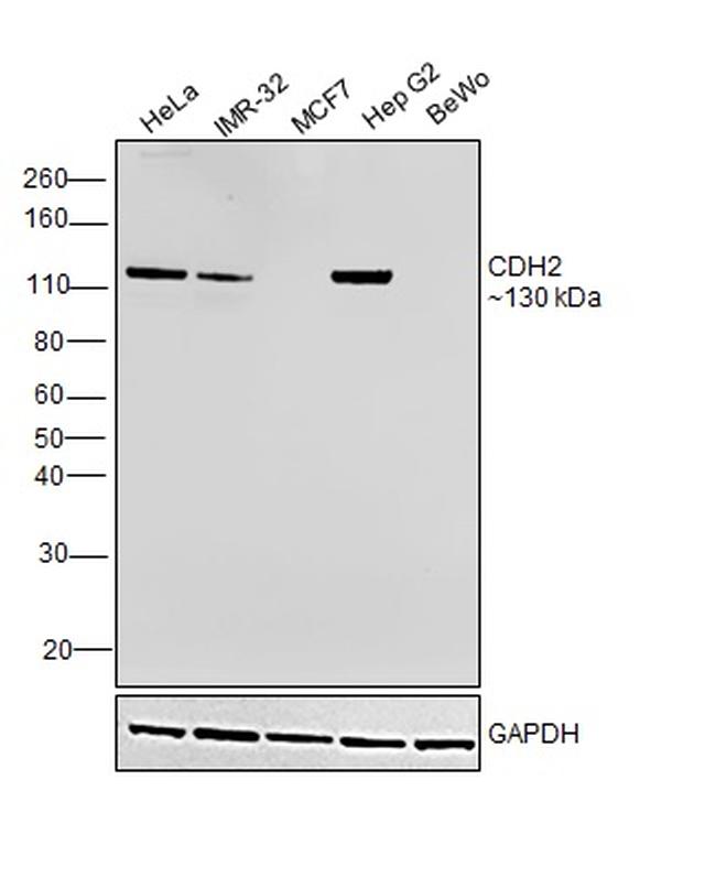 N-cadherin Antibody in Western Blot (WB)