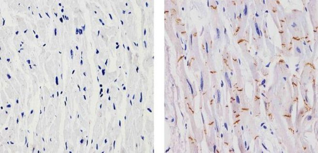 N-cadherin Antibody in Immunohistochemistry (Paraffin) (IHC (P))